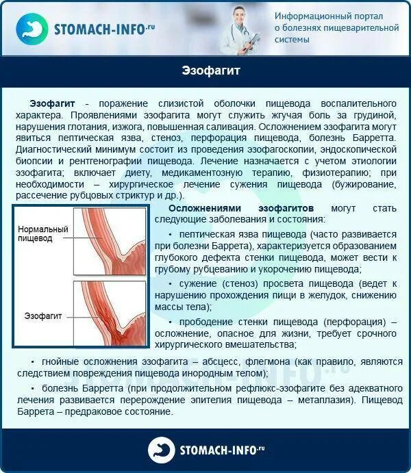 Рефлюкс эзофагит лечение у взрослых препараты. Рефлюкс эзофагит диета. диета при рефлюкс-эзофагите. диета при рефлюксе.