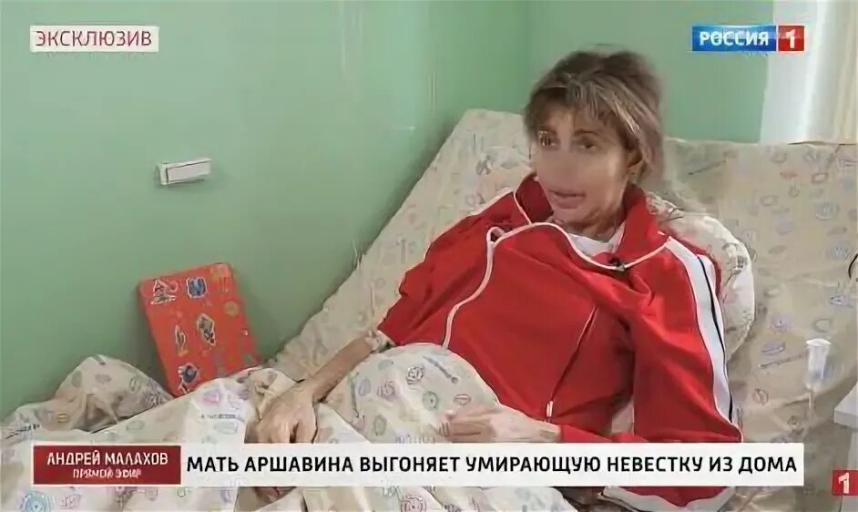 Алиса аршавина 2025. Алиса аршавина болезнь. алиса аршавина нос провалился.