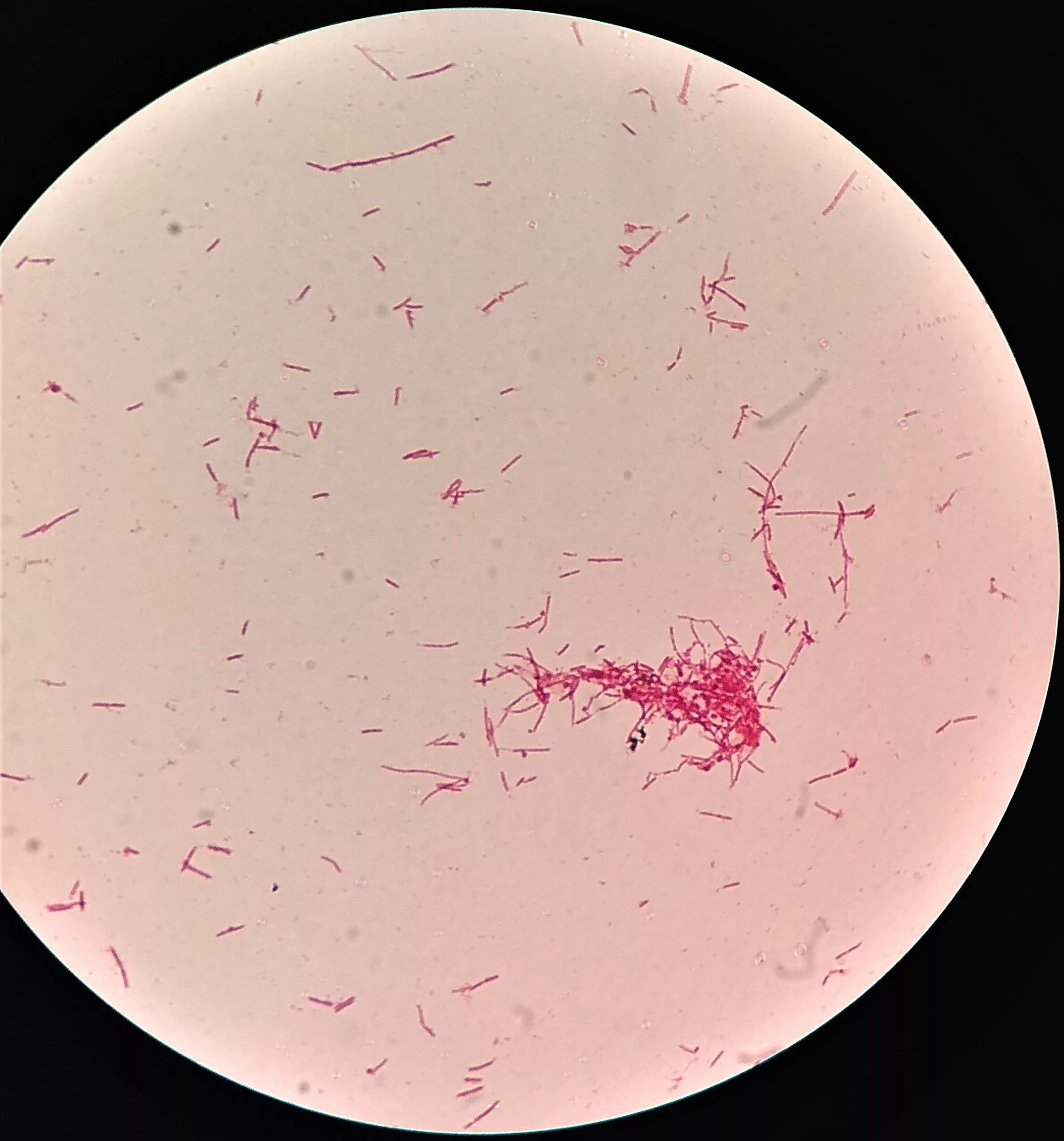 Эшерихиоз сальмонеллез. Escherichia coli микроскопия. Эшерихии кишечная палочка. Усрукшршф СЩДШ микроскоп.