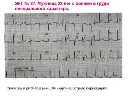 Сколько по времени длится экг