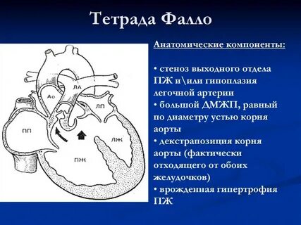 Впс 10