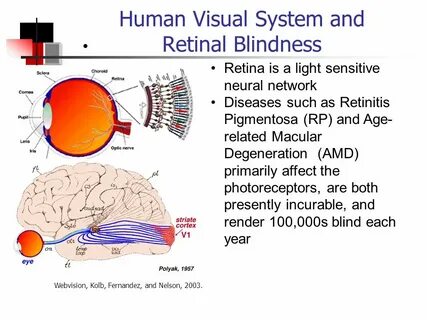 Related visual