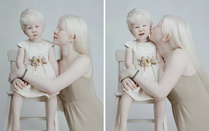 Появление в потомстве альбиноса. Сестры Калагановы альбиносы.