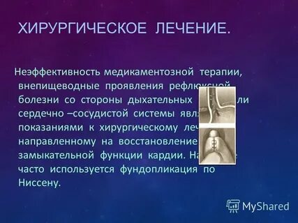Внепищеводные гэрб