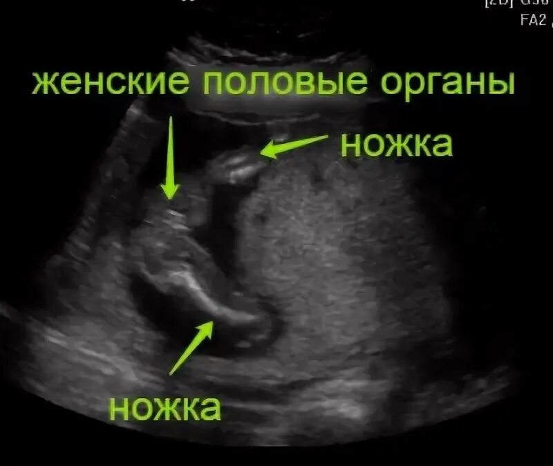 19 недель узи пол: найдено 82 картинок