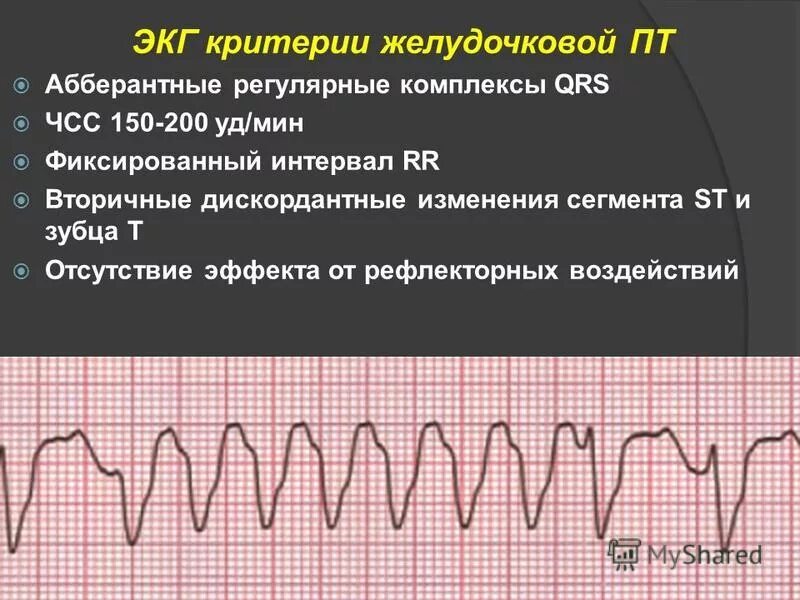 пароксизмальная форма фибрилляции предсердий экг. суправентрикулярная тахикардия экг. комплекс qrst на экг отражает. ав блокада 3 степени аускультация. экг – признаки пароксизмальной суправентрикулярной тахикардии.
