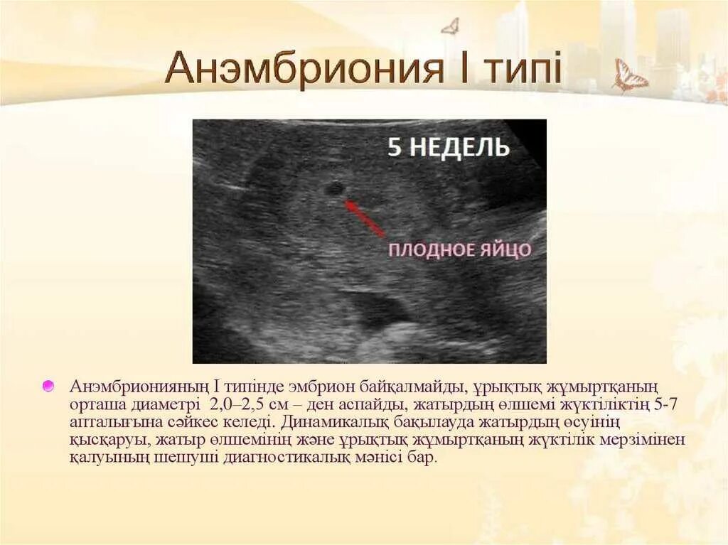 Яйцо растет эмбриона нет. Плодное яйцо анэмбриония. анэмбриония на узи как выглядит.
