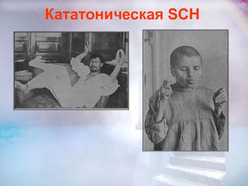 Кататоническое состояние. Кататоническая депрессия. Каталептический ступор. Кататонический синдром. Кататонический синдром ступор.