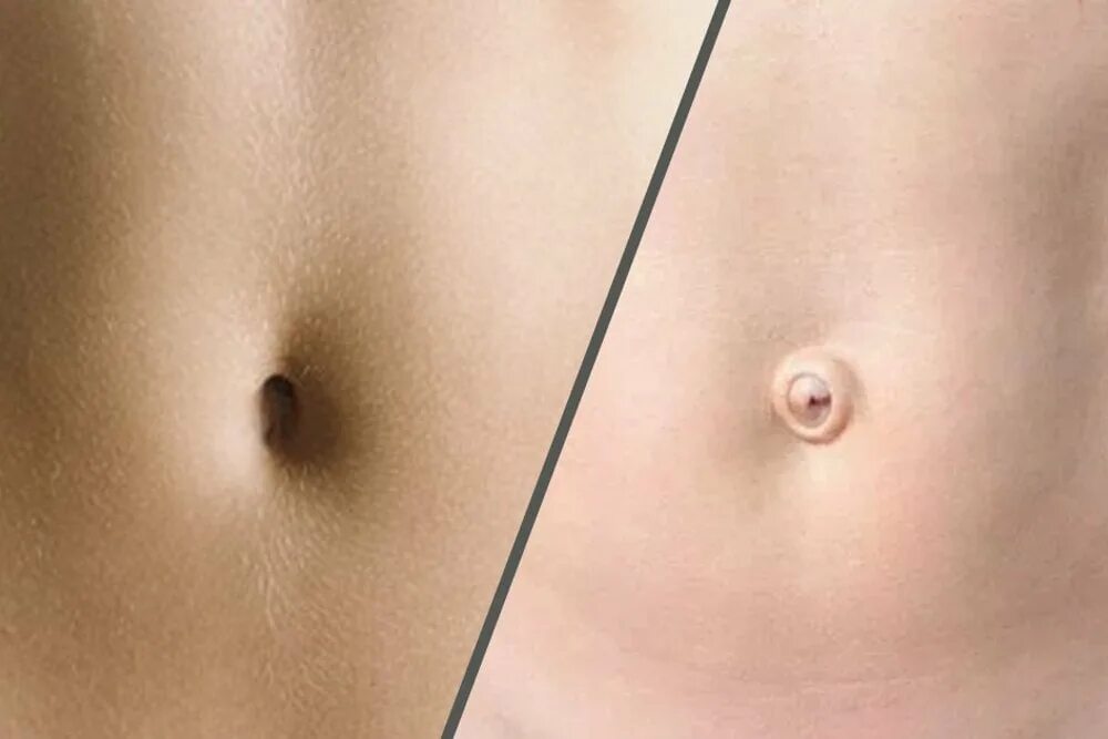 My Beautiful Navel NiceNavelGuy Italian Flickr