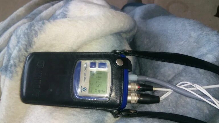 Холтер мигает. Аппарат смад для измерения давления суточный. Монитор суточного мониторирования экг "диамант-холтер". Холтеровское мониторирование ад. Сумка для холтера.