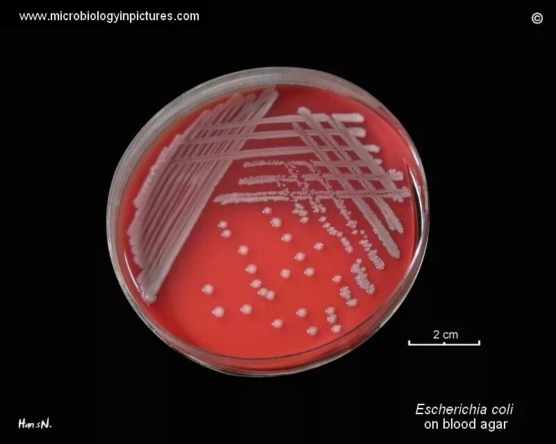 Coli sotwe. E.coli на кровяном агаре. Эшерихия микробиология. Эшерихия на кровяном агаре. Эшерихии коли.