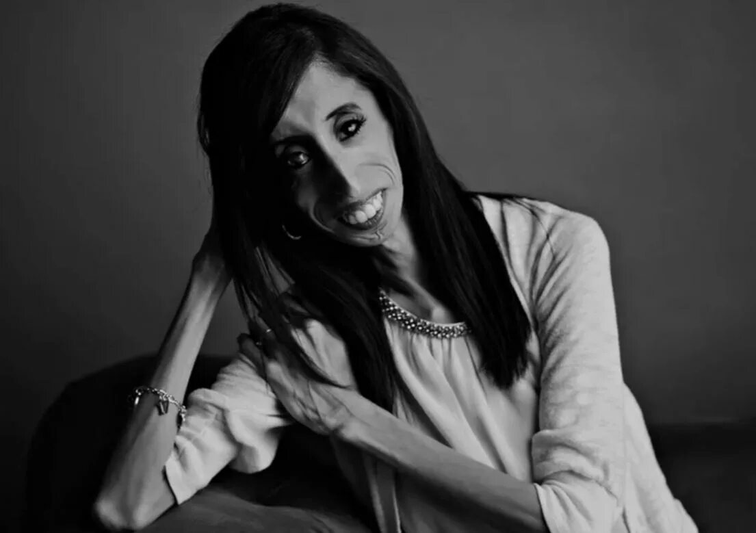 Ужасные бабы. Лиззи Веласкес Lizzie Velasquez. Самая некрасивая женщина в мире Лиззи Веласкес.