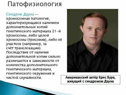 Синдром дауна люди с синдромом дауна