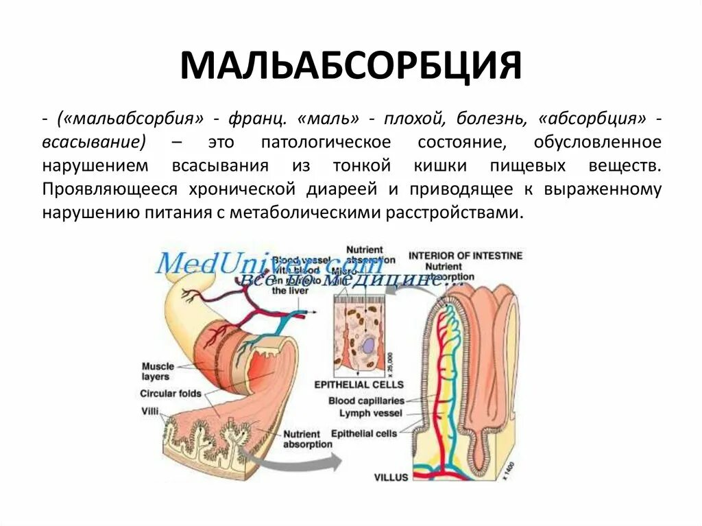 Мальабсорбция нарушение всасывания. Патогенез клинических проявлений синдрома мальабсорбции. Синдромы нарушения всасывания в пищеварительном тракте. Кишечные проявления синдрома мальабсорбции. Признаки тонкой кишки