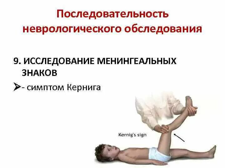 Ригидность мышц затылка симптом кернига. Симптом кернига и брудзинского. перечислите менингеальные симптомы. менингит симптомы кернига.
