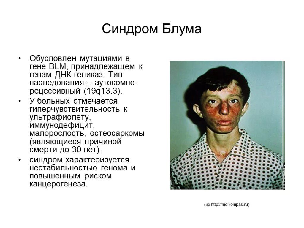 Мутация одного гена болезнь. Мутация одного гена болезнь