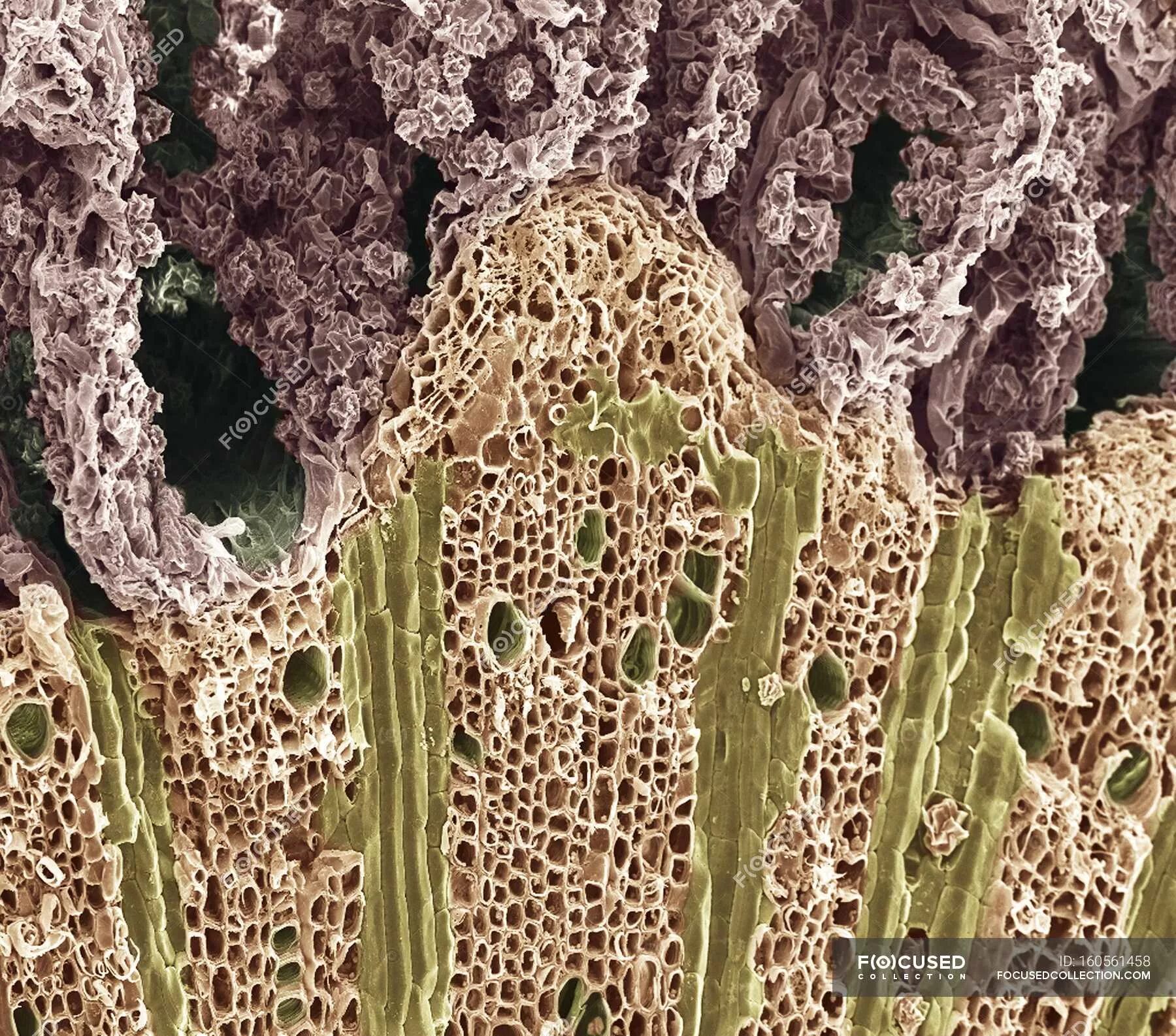 Микрофотография среза корень. Ксилема микроскоп. Ксилема микрофотография. Флоэма микрофотография. Микрофотографии тканей растений.