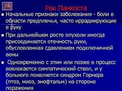 Рак панкоста