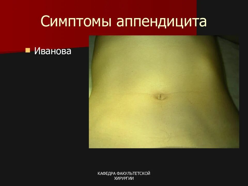 Аппендицит бывает у женщин. Аппендицит бывает у женщин