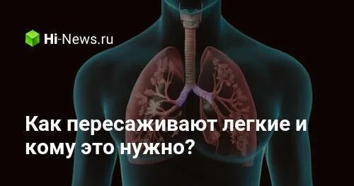 Трансплантация легких. Трансплантация легких. Трансплантация легких. Трансплантация легких. Трансплантация легких.