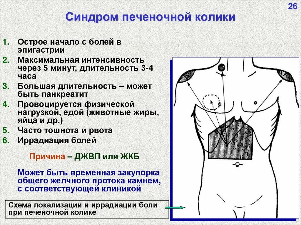 Колики в печени. Печеночная колика. Синдром печеночной колики. Локализация боли при печеночной колике. Желчная и печеночная колика.