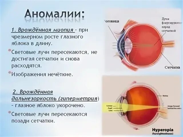 Отметьте один вариант ответа расположено впереди сетчатки