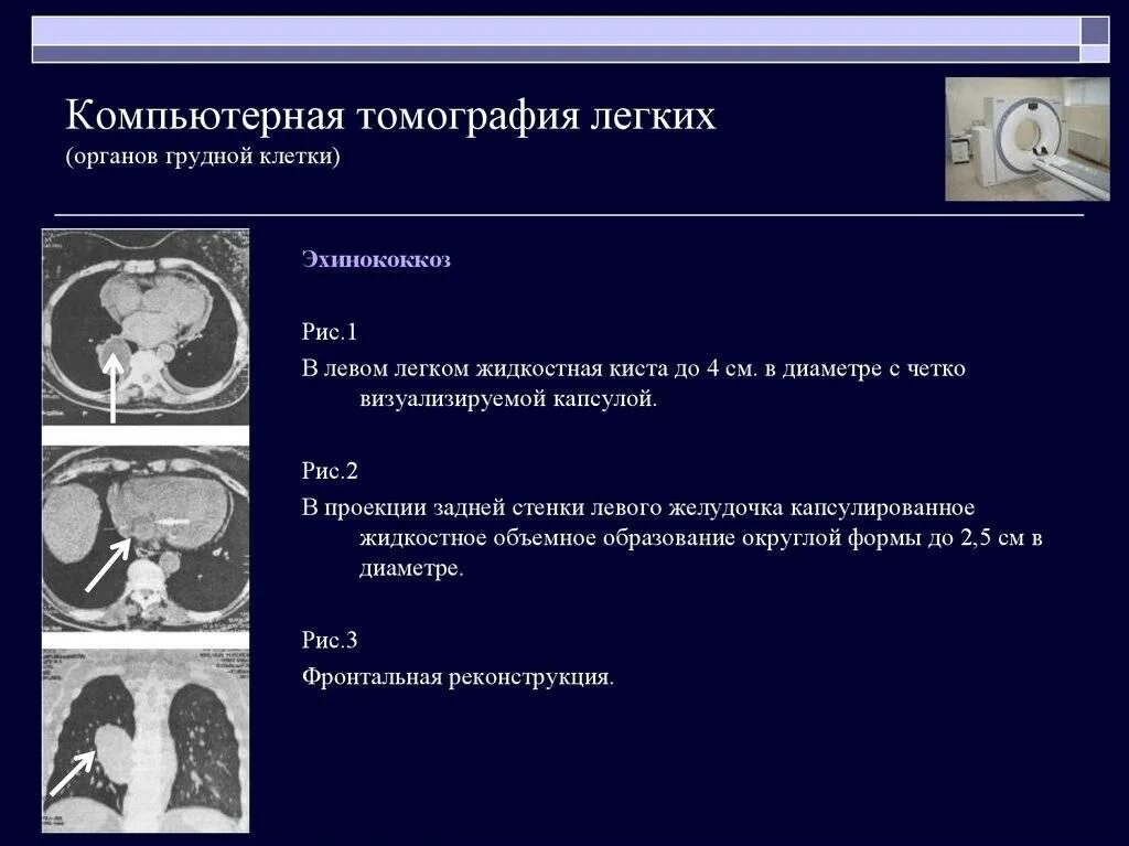 Можно ли делать два кт подряд