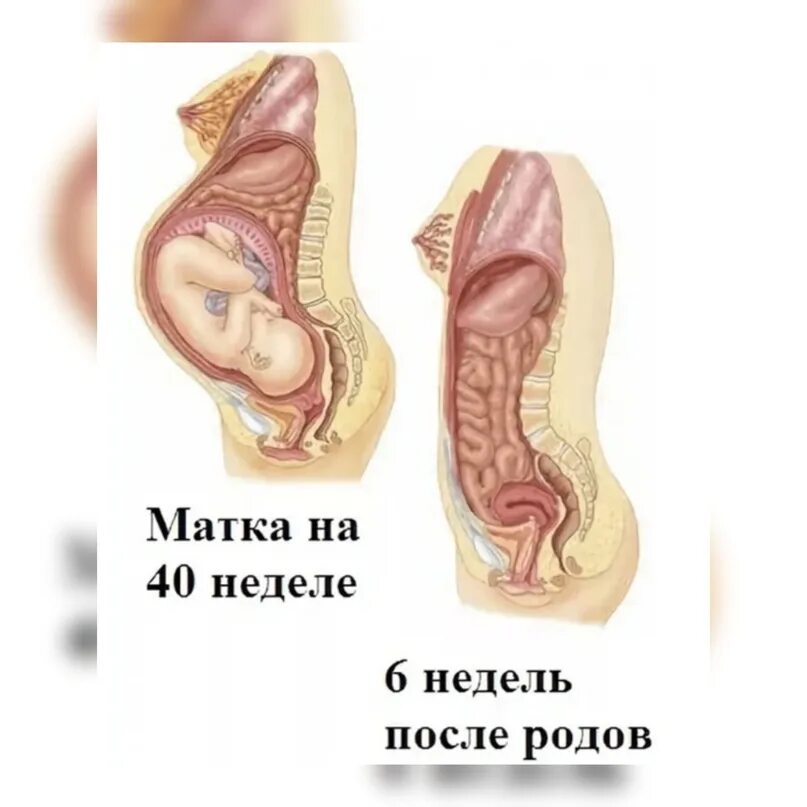 Матка через месяц после родов. Сокращение матки при родах. Матка после после родов.