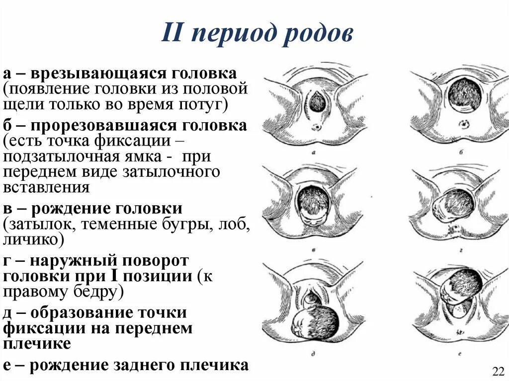 Срок рожать а схваток нет. Фазы второго периода родов. Врезывание и прорезывание головки. Периоды родов Длительность родов.