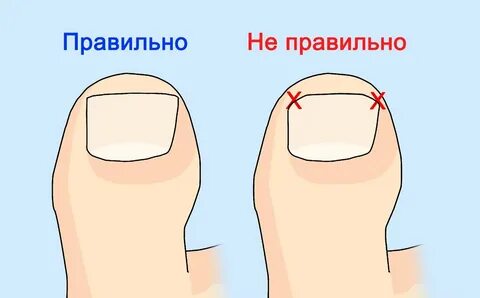 Валик на ногте большого пальца