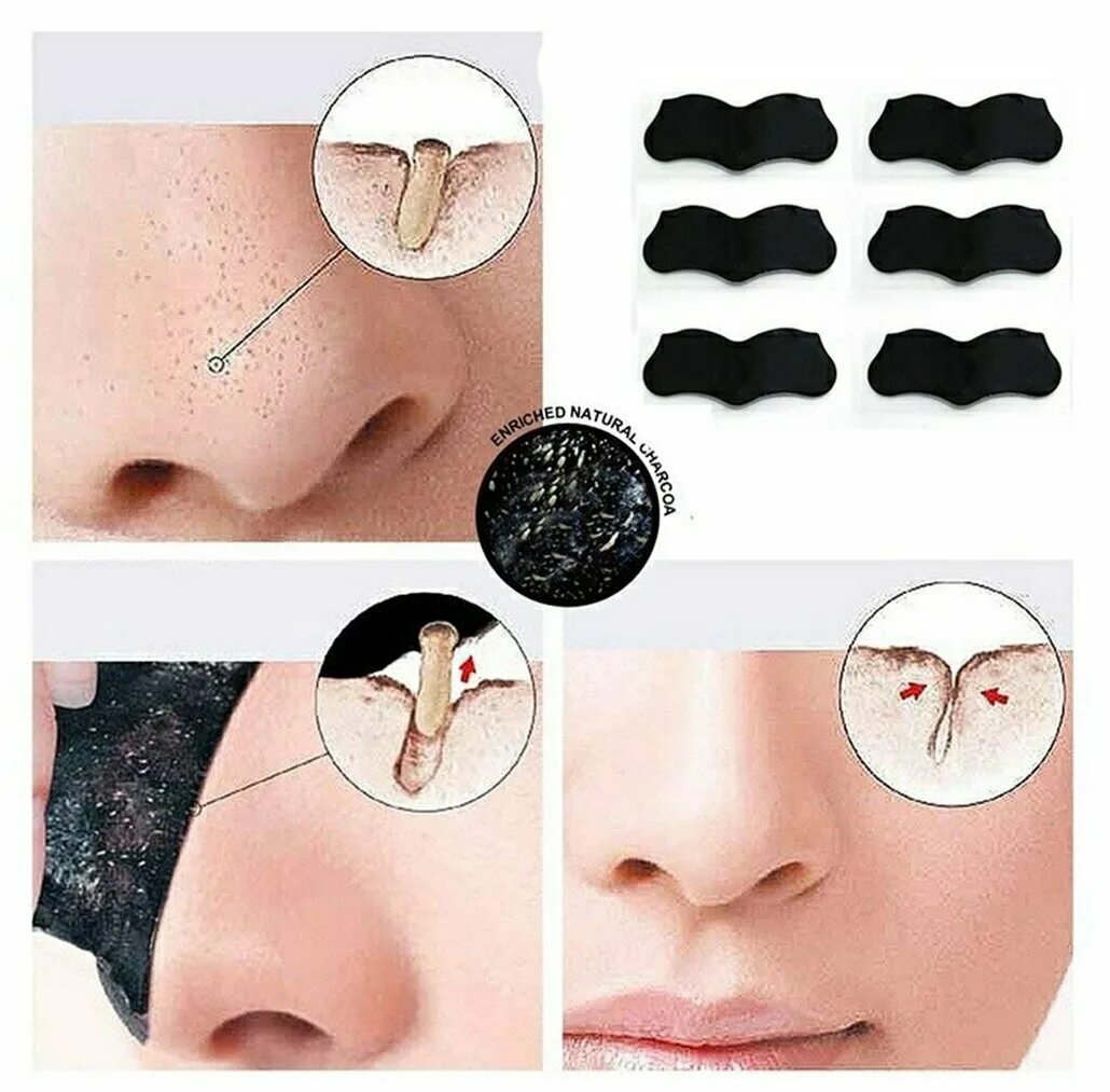 Блэк Хеад маска для носа. I'M petie маска для лица от черных точек Blackhead Remover Charcoal Mask - nose strip, 15 g. Black head Pore strip Life Ming Yuan Anti Blackhead nose Mask. Пластырь от черных точек на носу.