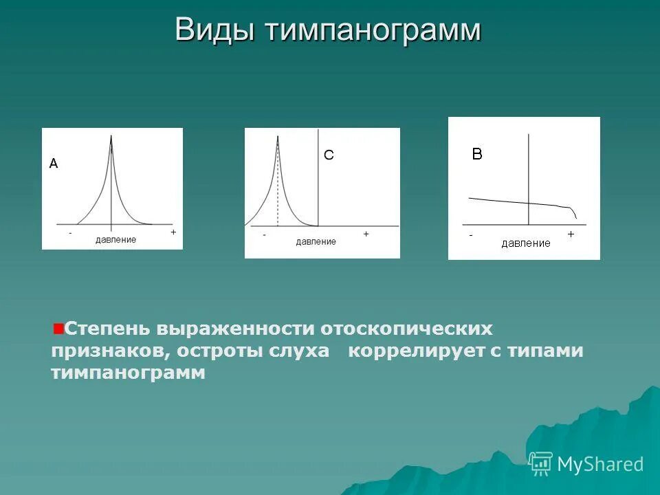 Типы тимпанограмм. Типы тимпанограмм. Тимпанометрия типы тимпанограмм. Тимпанометрия интерпретация результатов. Тимпанометрия типы тимпанограмм.