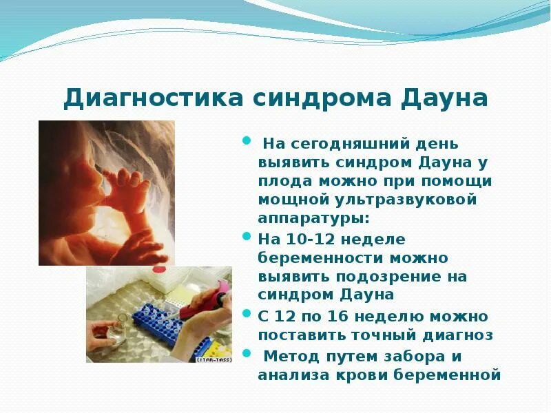 Дети с синдромом дауна причины. Узи плода с синдромом дауна в 12 недель. Неиммунная водянка плода. Симптомы дауна при беременности на узи. Признаки синдрома дауна на узи 12 недель.