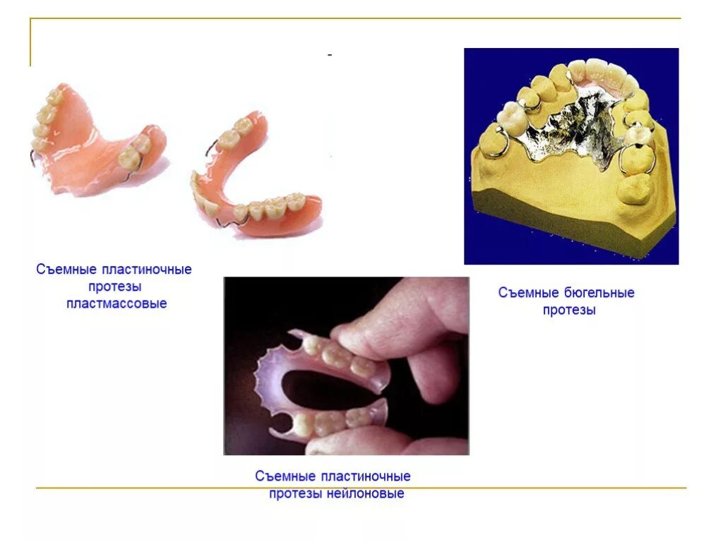 Клинико лабораторные этапы съемных пластиночных протезов. Пластиночный протез съемный части. Съемный пластиночный протез составные элементы. Конструктивные элементы съемных пластиночных протезов. Съёмный пластиночный протез состоит из:.