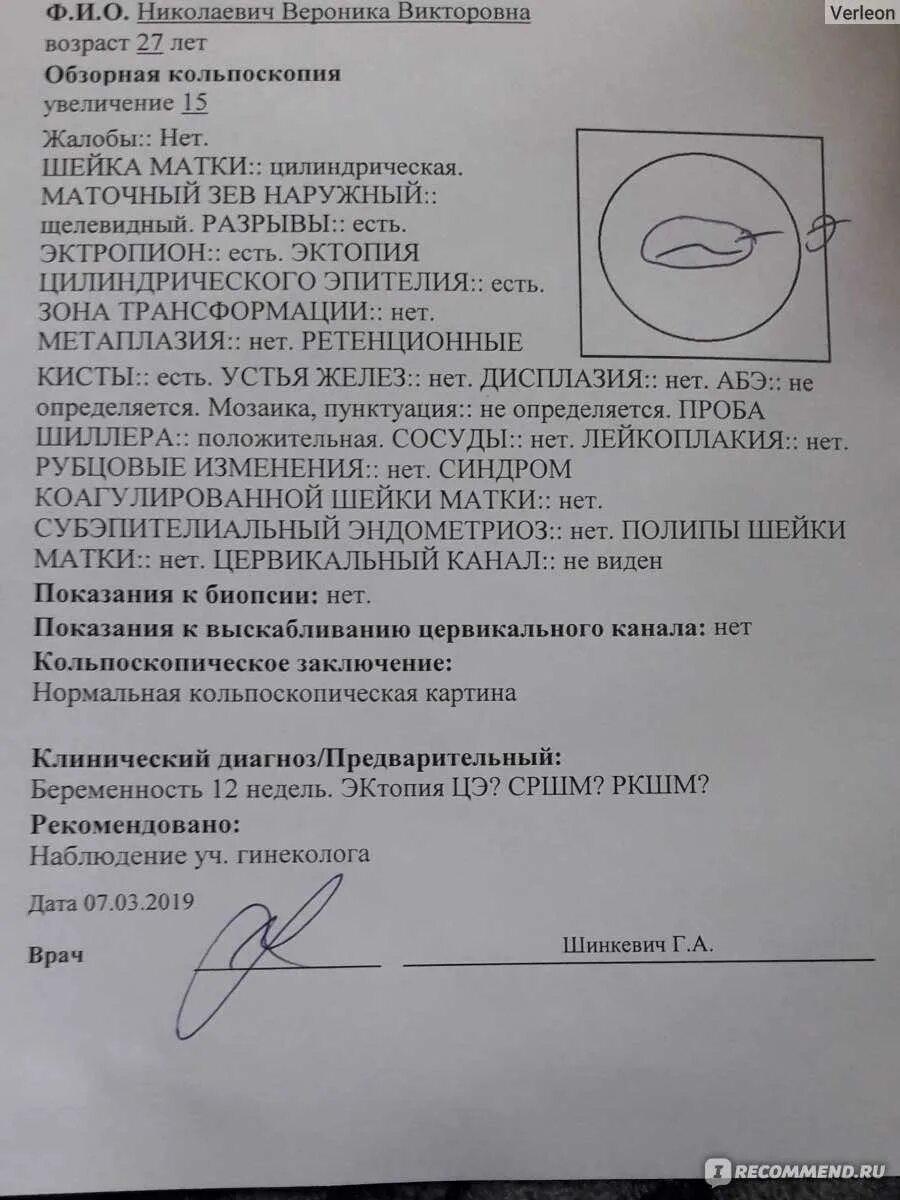 Как выглядит кольпоскопия шейки матки. Кольпоскопия заключение эрозия шейки матки. кольпоскопия заключение норма. патологии шейки матки кольпоскопия. кольпоскопическая картина эктопии шейки матки.