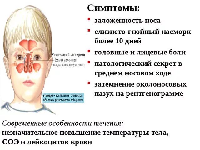 Болит нос при простуде