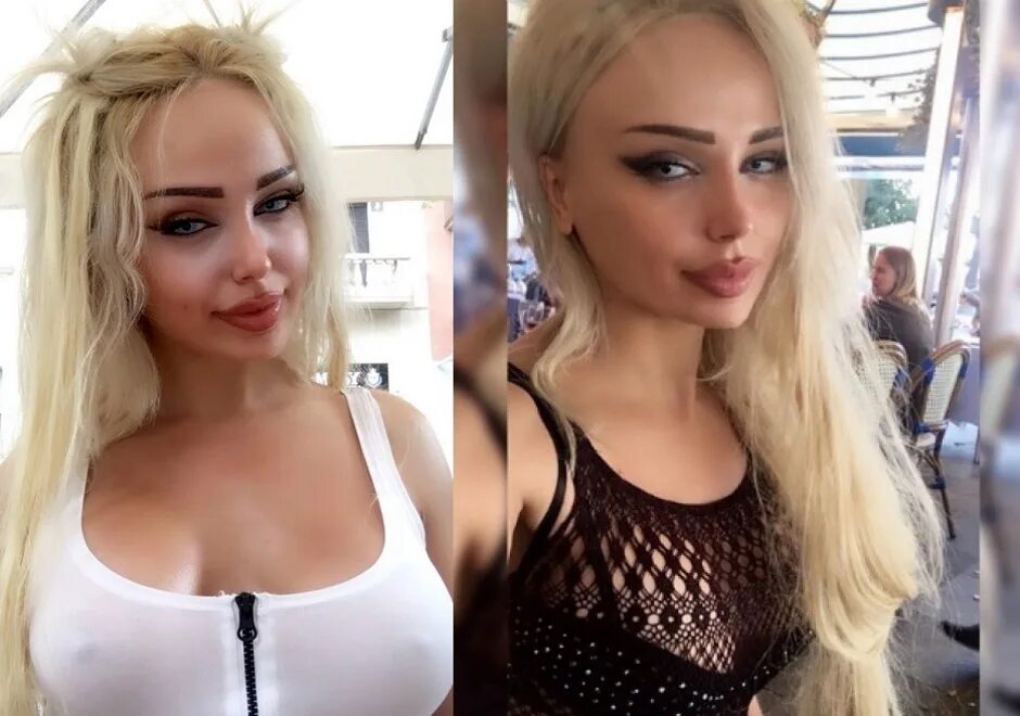 Лили Морто делала пластику? Где смотреть фото до и после пластики?