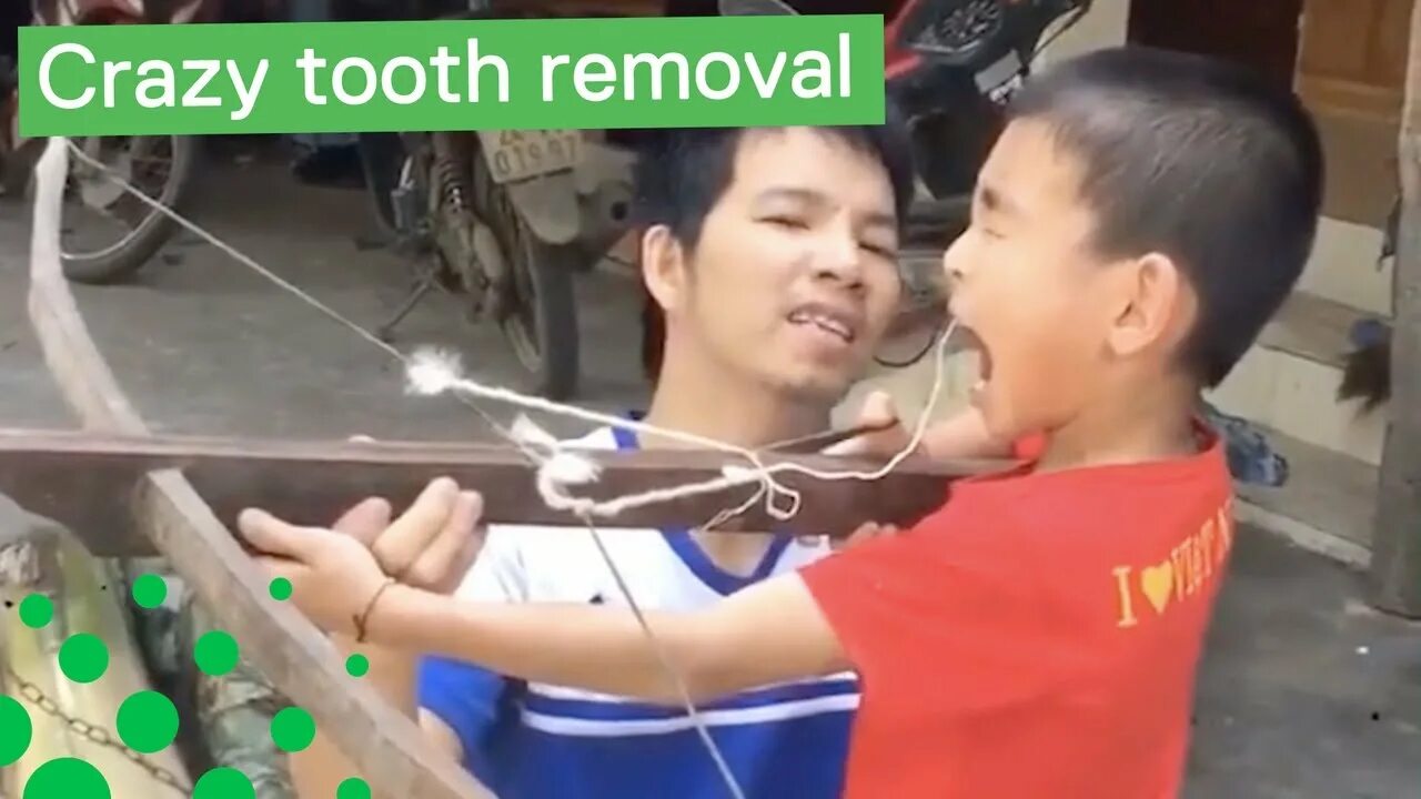 Вырывание зубов веревочкой. Дернуть зуб за веревку. Мальчик который вывел 100 человек