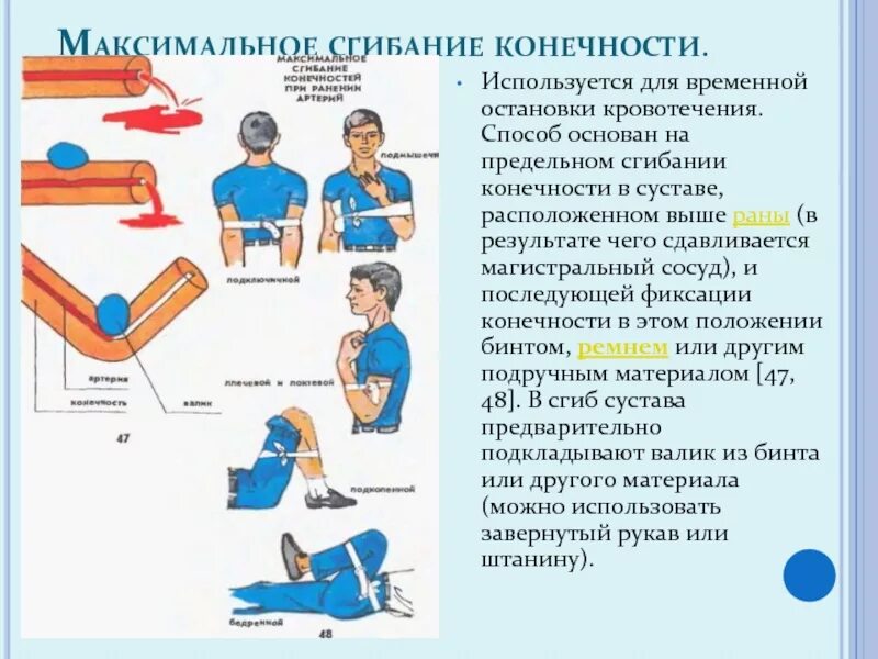 Способы и особенности фиксации конечностей. Остановке наружного кровотечения способом максимального сгибания. Остановка кровотечения максимальным сгибанием конечности алгоритм. Остановка кровотечения методом предельного сгибания. Максимальное сгибание конечности для остановки кровотечения.