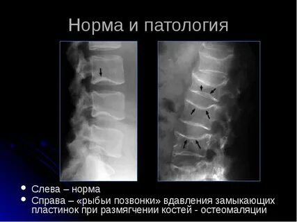 Норма и патология человека