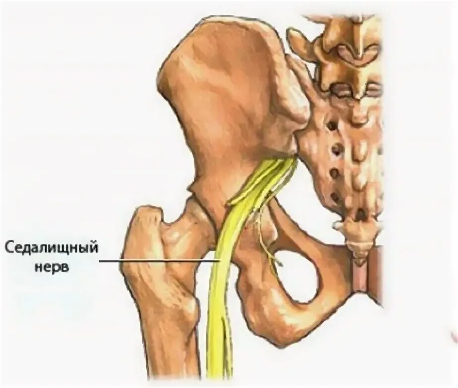 Седалищный сустав. Седалищный нерв (sciatic nerve)? 011. защемление костей. где находится седалищный позвоночник. таблетки от защимление нерв.