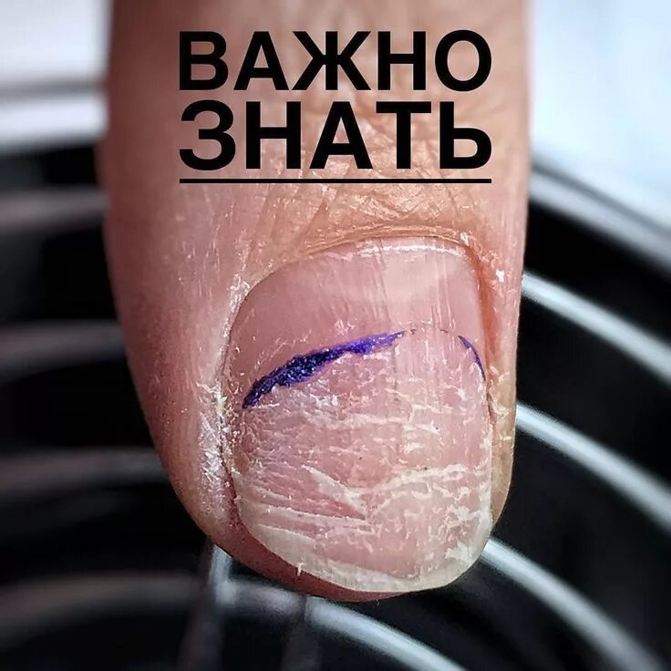 Снятие гель лака с ногтей. Кузов лкп что это. Маникюр осень 2022 модные. Оторванное покрытие. Оторванное покрытие на ногтях.