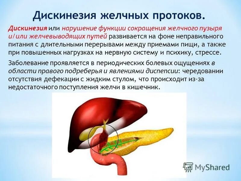 дискинезия желчных путей. заболевания желчевыводящих путей симптомы. расположение желчного пузыря в организме человека. дискинезии желчного пузыря и желчевыводящих путей. дискинезии желчного пузыря и желчевыводящих путей.