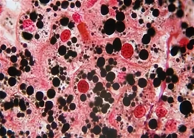В клетках печени курицы содержится больше всего. Жировые включения осмиевая кислота сафранин. включения жира в клетках печени гистология. жировые включения препарат гистология. окраска осмиевой кислотой гистология.