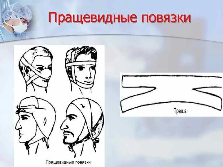 Техника наложения пращевидной повязки