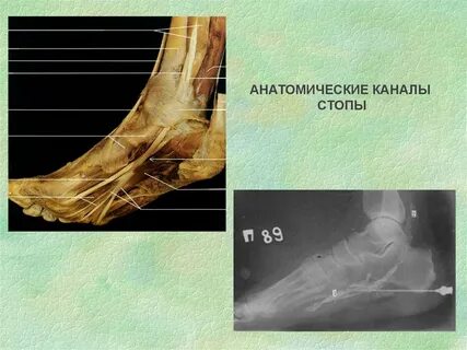 Каналы стопы