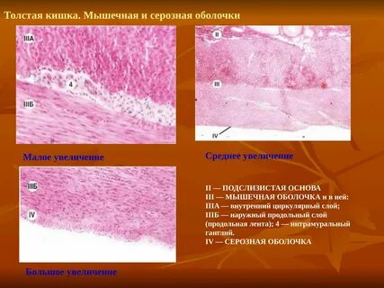 Толщина мышечного слоя является наибольшей в