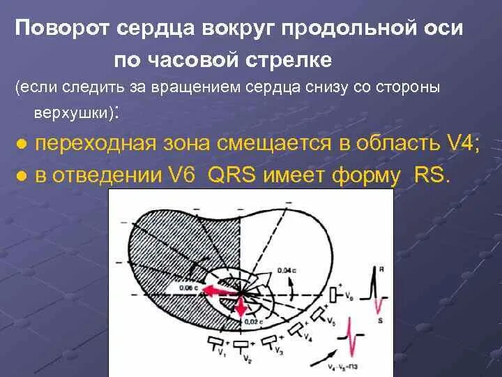 Поворот сердца правым желудочком вперед что это. Повороты сердца на ЭКГ вокруг продольной оси. ЭКГ поворот сердца продольной оси. ЭКГ признаки поворота сердца вокруг продольной оси по часовой. Поворот сердца вокруг продольной оси по часовой стрелке.