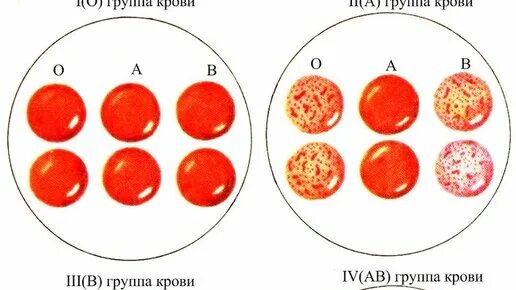 Сыворотки крови Изогемагглютинация. Реакция изогемагглютинации. Изогемагглютинация группы крови. Метод стандартных сывороток.