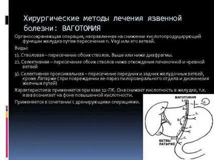Язвенная болезнь хирургические болезни